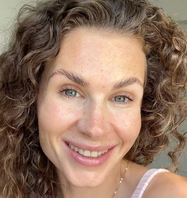 Lachende Frau mit natürlicher, sensibler Gesichtshaut.