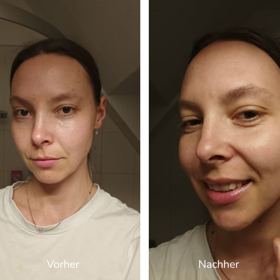 Vorher-nachher-Vergleich der Gesichtshaut in zwei Bildern.