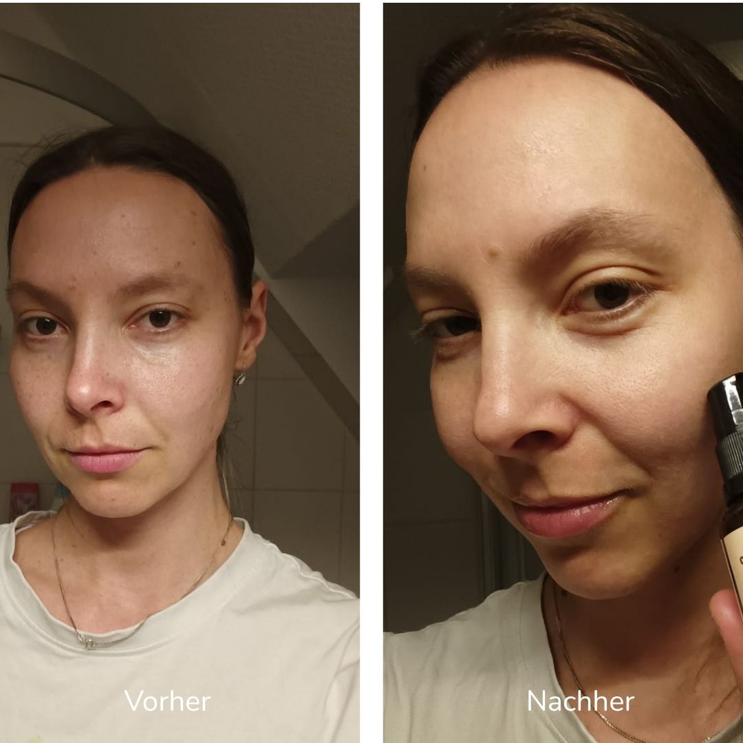 Vorher-nachher-Vergleich der Gesichtshaut in zwei Bildern.